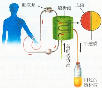 血液透析的病人怎么喝水